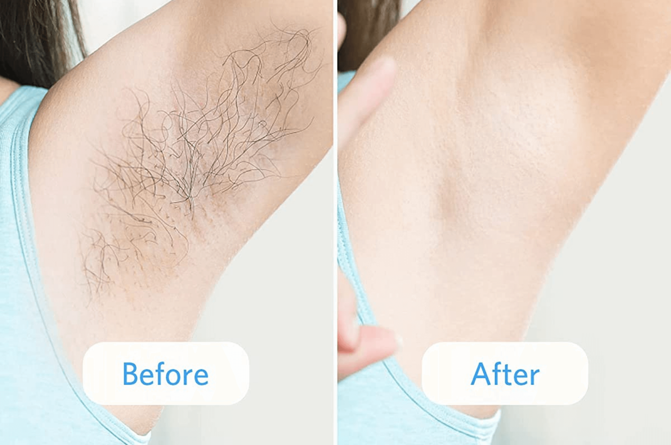 Marias Beauty Secrets | Premium IPL Laser Hair Removal