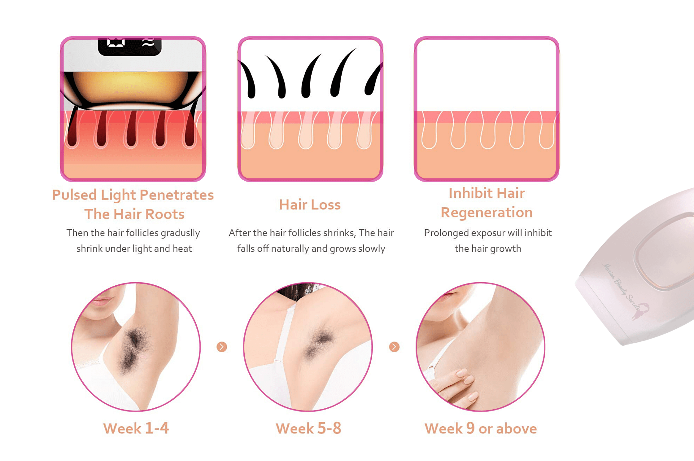 Marias Beauty Secrets | Premium IPL Laser Hair Removal